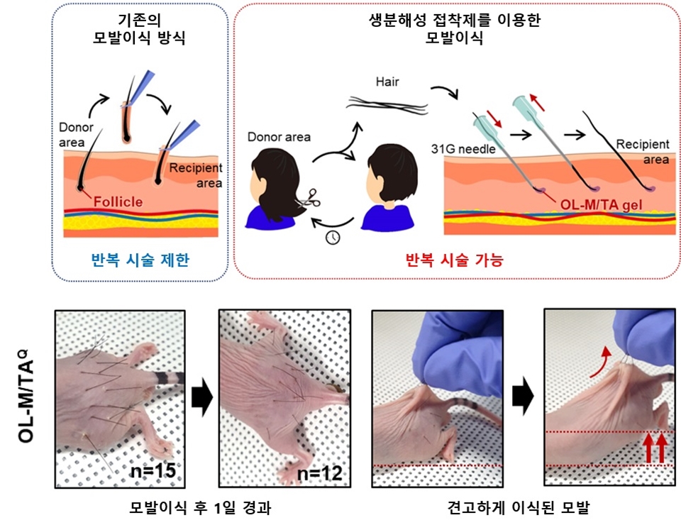 (위) 모낭을 포함하는 모발을 이식하는 기존의 모발 이식 방식(왼쪽) 대비 생분해성 접착제를 이용한 모발 이식 방식(오른쪽)의 개요. 모발 끝에 접착제를 도포한 후 피하주사를 통해 이식함으로써 피부에 고정하며, 반복 시술이 가능하다. (아래) 초기 동물실험 결과. 15가닥의 모발을 이식한 후 1일 경과한 상태에서 12가닥의 모발이 남아있다. 3가닥의 모발을 잡아당기면 몸 전체가 끌려올라오는 것으로 보아 피부에 견고하게 이식된 것을 알 수 있다. 접착제를 사용하지 않으면 모발이 남지 않으며, 열처리하지 않은 접착제의 경우 1/7 수준의 효율을 보였다. (그림=카이스트)
